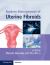 Modern Management of Uterine Fibroids