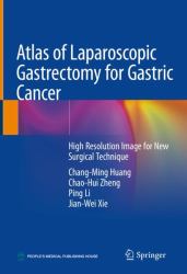 Atlas of Laparoscopic Gastrectomy for Gastric Cancer : High Resolution Image for New Surgical Technique