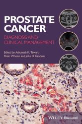 Prostate Cancer : Diagnosis and Clinical Management