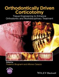 Orthodontically Driven Corticotomy : Tissue Engineering to Enhance Orthodontic and Multidisciplinary Treatment