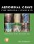 Abdominal X-Rays for Medical Students