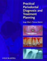 Practical Periodontal Diagnosis and Treatment Planning