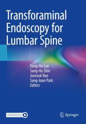 Transforaminal Endoscopy for Lumbar Spine