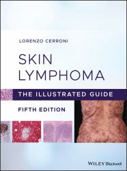 Skin Lymphoma : The Illustrated Guide