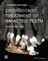 Orthodontic Treatment of Impacted Teeth