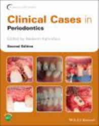 Clinical Cases in Periodontics