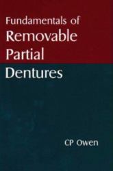 Fundamentals of Removable Partial Dentures