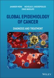 Global Epidemiology of Cancer : Diagnosis and Treatment