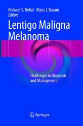 Lentigo Maligna Melanoma : Challenges in Diagnosis and Management