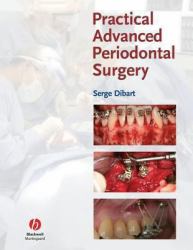 Practical Advanced Periodontal Surgery