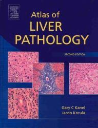 Atlas of Liver Pathology