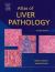 Atlas of Liver Pathology