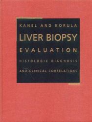 Liver Biopsy Evaluation : Histologic Diagnosis with Clinical Correlations