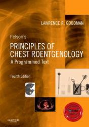 Felson's Principles of Chest Roentgenology