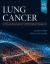 Lung Cancer : An Evidence-Based Approach to Multidisciplinary Management