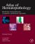 Atlas of Hematopathology : Morphology, Immunophenotype, Cytogenetics, and Molecular Approaches