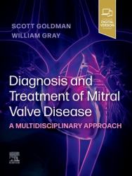 Diagnosis and Treatment of Mitral Valve Disease : A Multidisciplinary Approach