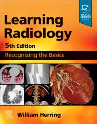 Learning Radiology : Recognizing the Basics