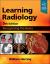 Learning Radiology : Recognizing the Basics