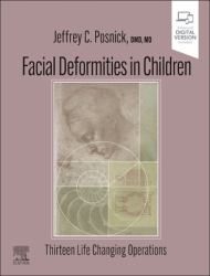 Facial Deformities in Children : Thirteen Life Changing Operations