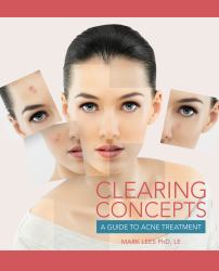 Clearing Concepts : A Guide to Acne Treatment