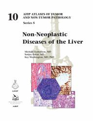 Non-Neoplastic Diseases of the Liver : 5f10