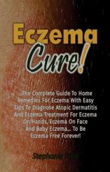 Eczema Cure!: the Complete Guide to Home Remedies for Eczema with Easy Tips to Diagnose Atopic Dermatitis and Eczema Treatment for Eczema on Hands, Eczema on Face and Baby Eczema... to Be Eczema Free