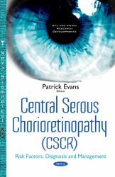 Central Serous Chorioretinopathy (CSCR) : Risk Factors, Diagnosis and Management