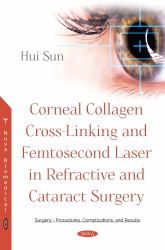 Corneal Collagen Cross-Linking and Femtosecond Laser in Refractive and Cataract Surgery