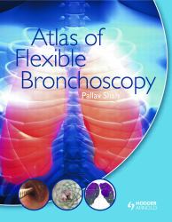 Atlas of Flexible Bronchoscopy