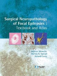 Surgical Neuropathology of Focal Epilepsies : Textbook and Atlas