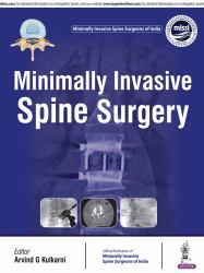 Minimally Invasive Spine Surgery