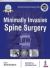 Minimally Invasive Spine Surgery