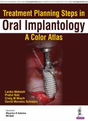 Treatment Planning Steps in Oral Implantology : A Color Atlas