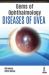 Gems of Ophthalmology: Diseases of Uvea