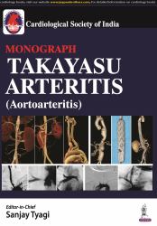 Takayasu Arteritis (aortoarteritis) Hb : Takayasu Arteritis (Aortoarteritis)