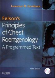 Felson's Principles of Chest Roentgenology : A Programmed Text