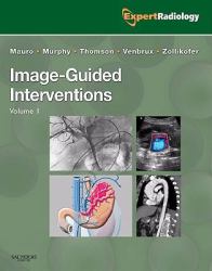 Image-Guided Intervention