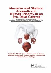 Muscular and Skeletal Anomalies in Human Trisomy in an Evo-Devo Context