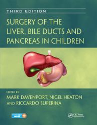 Surgery of the Liver, Bile Ducts and Pancreas in Children