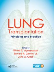 Lung Transplantation : Principles and Practice