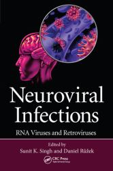 Neuroviral Infections