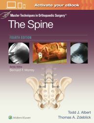 Master Techniques in Orthopaedic Surgery: the Spine