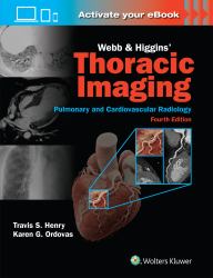 Webb and Higgins Thoracic Imaging: Print + EBook with Multimedia