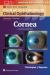 Cornea - Print + Ebook with Multimedia