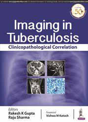 Imaging in Tuberculosis : Clinicopathological Correlation