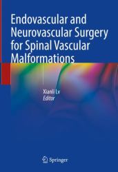 Endovascular and Neurovascular Surgery for Spinal Vascular Malformations