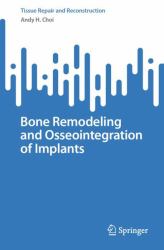 Bone Remodeling and Osseointegration of Implants