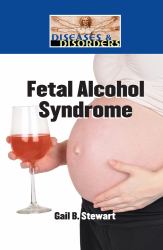 Fetal Alcohol Syndrome