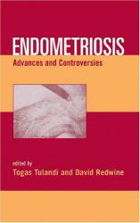 Endometriosis : Advances and Controversies